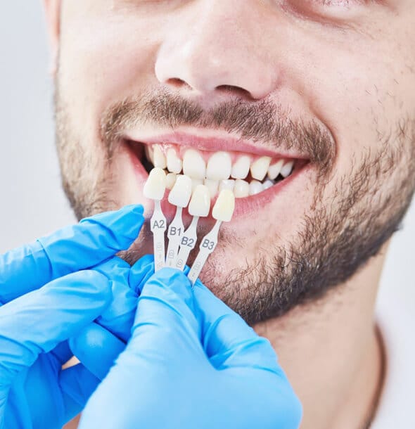 Dentist in blue gloves showing patient tooth shade guide for color matching during dental consultation.