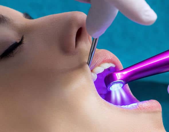 Dental professional performing teeth whitening procedure with UV light on patient's mouth.