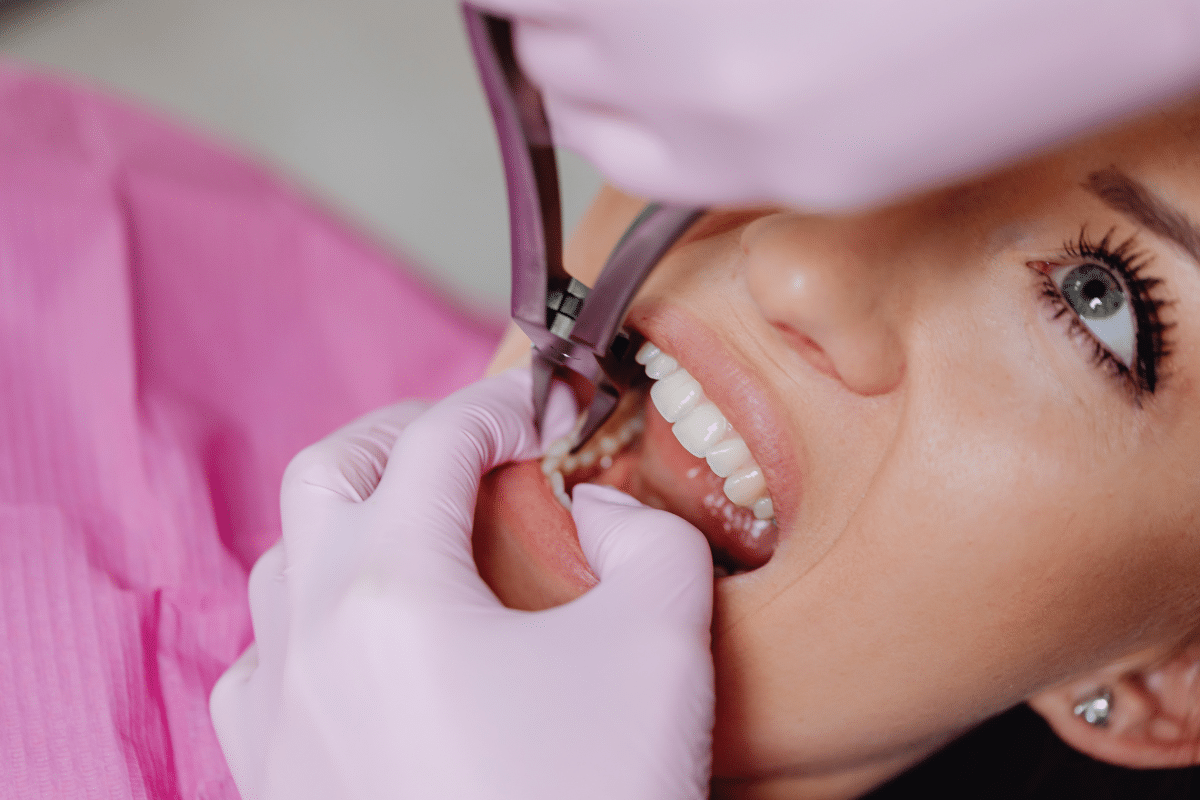 How Painful Is the Dental Implant Procedure and What Can You Expect During Recovery?